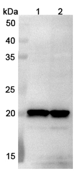 NME6 Rabbit Polyclonal Antibody