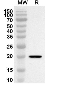 NRP2 Rabbit Polyclonal Antibody