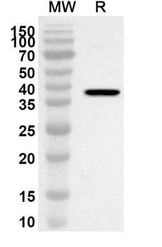FGF16 Rabbit Polyclonal Antibody