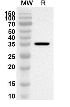 CCL16/HCC-4 Rabbit Polyclonal Antibody