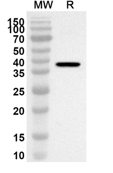 P4HA2 Rabbit Polyclonal Antibody