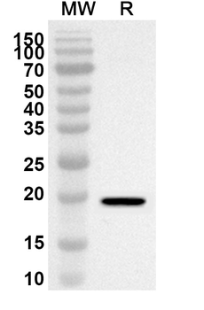 ANGPT2 Rabbit Polyclonal Antibody