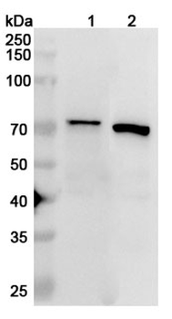 IGF2BP3 Rabbit Polyclonal Antibody