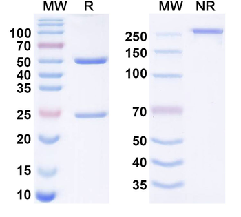 AFP/Alpha-fetoprotein Monoclonal Mouse Monoclonal Antibody