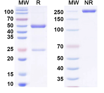 HBV HBcAg Monoclonal Mouse Monoclonal Antibody