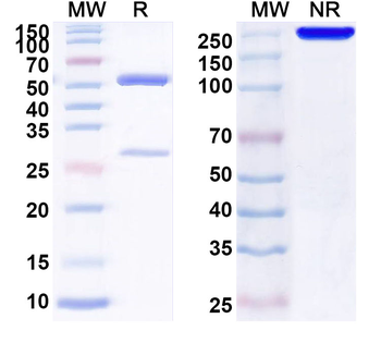 AFP/Alpha-fetoprotein Monoclonal Mouse Monoclonal Antibody