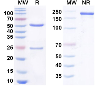 SARS-CoV-2 NP/Nucleoprotein Monoclonal Mouse Monoclonal Antibody