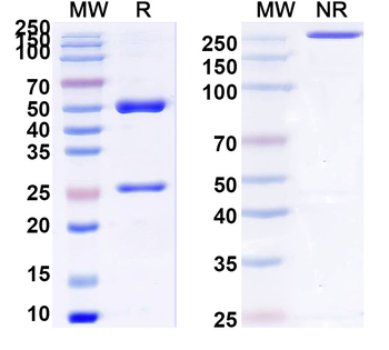 TobRV/TRSV 2C-CP/Coat protein Monoclonal Mouse Monoclonal Antibody