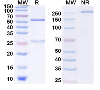 S100B Monoclonal Mouse Monoclonal Antibody