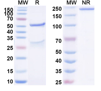 S100B Monoclonal Mouse Monoclonal Antibody
