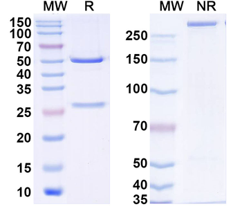 S100B Monoclonal Mouse Monoclonal Antibody