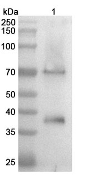 GPC3 Monoclonal Mouse Monoclonal Antibody