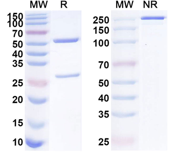 ASFV EP84R Mouse Monoclonal Antibody