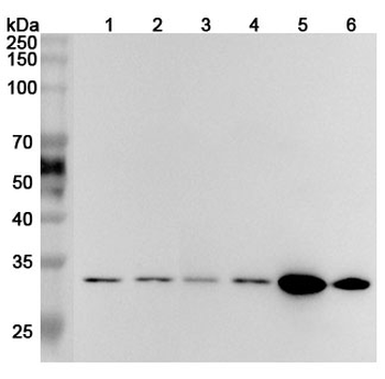 VDAC1 Rabbit Polyclonal Antibody