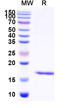 Influenza A virus RNA polymerase complex Camelus Monoclonal Antibody