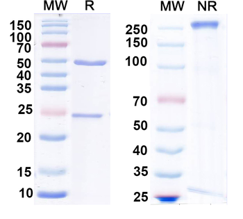 MARV GP/Envelope glycoprotein Human Monoclonal Antibody