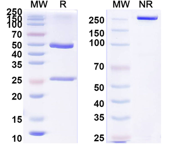 TBEV Envelope protein E Mouse Monoclonal Antibody