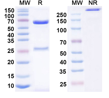 Measles virus/MeV F/Fusion Mouse Monoclonal Antibody