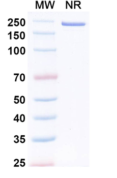 Sindbis virus(SINV) Spike glycoprotein E2 Mouse Monoclonal Antibody