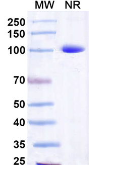 Norovirus/Norwalk virus Capsid protein/VP1 Human Monoclonal Antibody