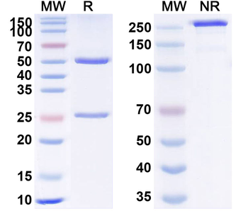 Norovirus/Norwalk virus Capsid protein/VP1 Human Monoclonal Antibody