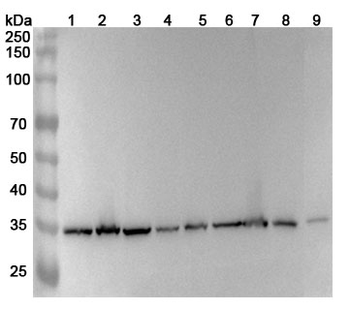 PCNA Human Monoclonal Antibody