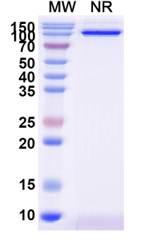 DKK1 Human Monoclonal Antibody