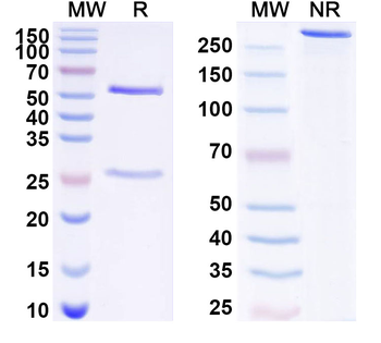CBX5 IP Mouse Monoclonal Antibody