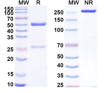 KDM6B IP Mouse Monoclonal Antibody
