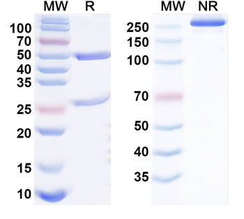 KDM5C IP Mouse Monoclonal Antibody