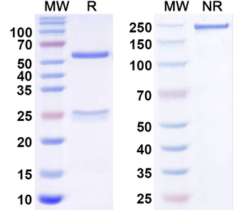 KDM4B IP Mouse Monoclonal Antibody