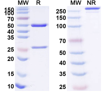 KDM4A IP Mouse Monoclonal Antibody