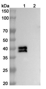 HRSV/hMPV Fusion glycoprotein Neutralizing Human Monoclonal Antibody