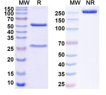 HBV preS2 domain Mouse Monoclonal Antibody