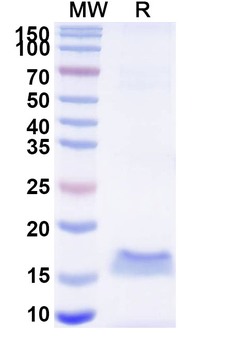 HMPV Fusion glycoprotein F0 Camelus Monoclonal Antibody