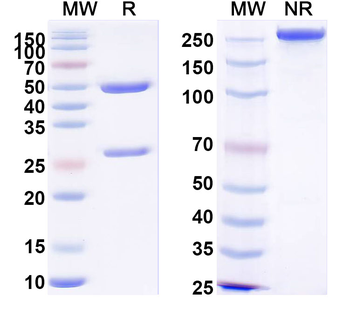 Nipah virus/NiV Glycoprotein G Human Monoclonal Antibody