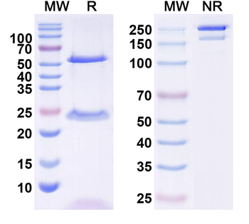 HCV E1/E2 Complex Human Monoclonal Antibody