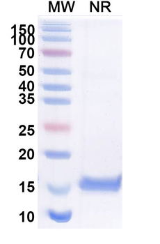 SARS-CoV-2 RBD Camelus Monoclonal Antibody