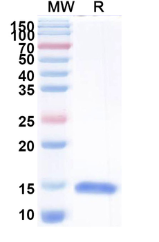Helicobacter pylori ureB/Urease subunit beta Camelus Monoclonal Antibody