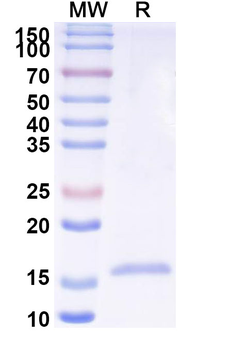 PIV5 Protein P Camelus Monoclonal Antibody
