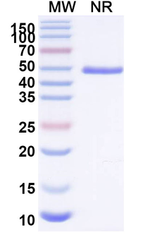 BVDV Envelope glycoprotein E2 Human Monoclonal Antibody