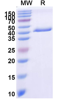 BVDV Envelope glycoprotein E2 Human Monoclonal Antibody