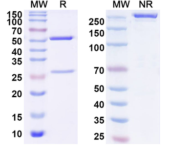 SARS-CoV-2 RBD Human Monoclonal Antibody