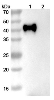 CD38 Mouse Monoclonal Antibody