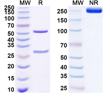 IL21 Human Monoclonal Antibody