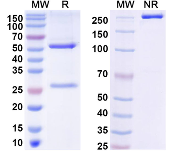 SARS-CoV-2 RBD (S 6P trimer) Human Monoclonal Antibody