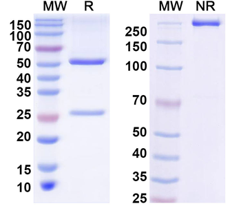 Influenza A virus (H5N1) HA/Hemagglutinin Human Monoclonal Antibody