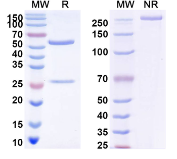 DENV-4 Envelope protein E/EDIII domain Human Monoclonal Antibody