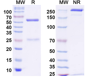 SARS-CoV-2 Spike Protein Human Monoclonal Antibody