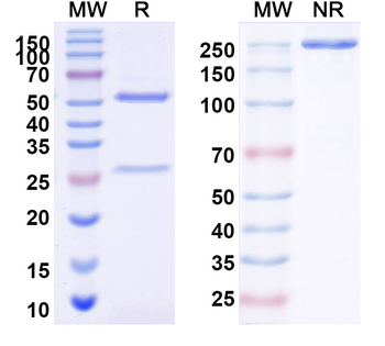 PRRSV NP/Nucleoprotein Mouse Monoclonal Antibody